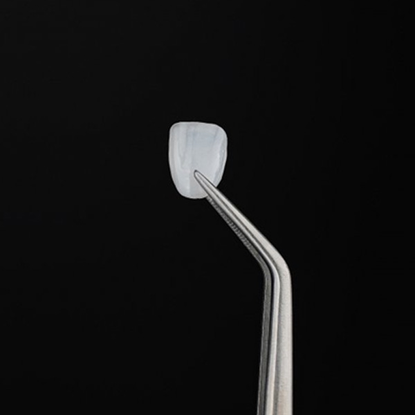 Veneer held with tweezers