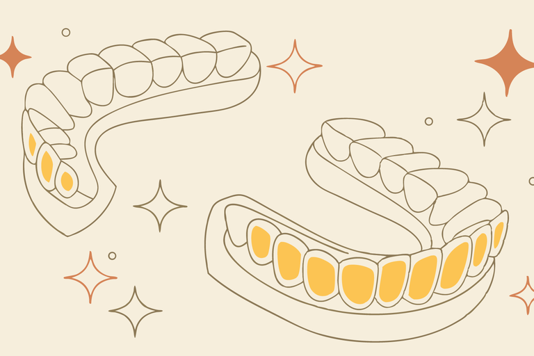 Yellow Invisalign Retainer Help! My Invisalign Aligners Are Turning Yellow!